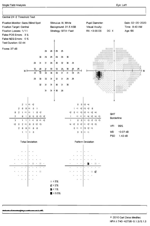 Tests & Diagnostics - Memorial Eye Institute - LASIK Harrisburg